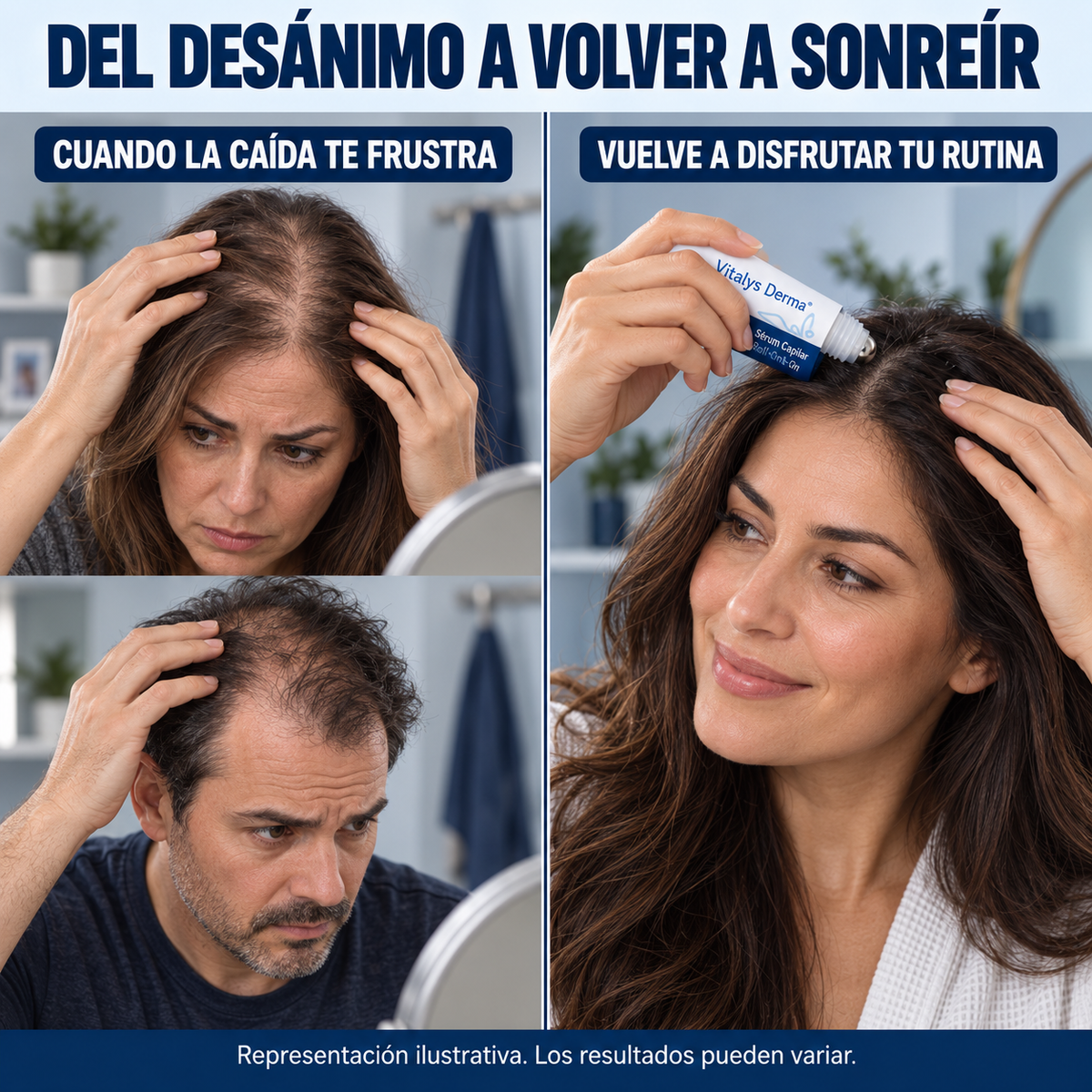 Vitalys Derma® - No es genética. Es que nunca llegó a tu raíz